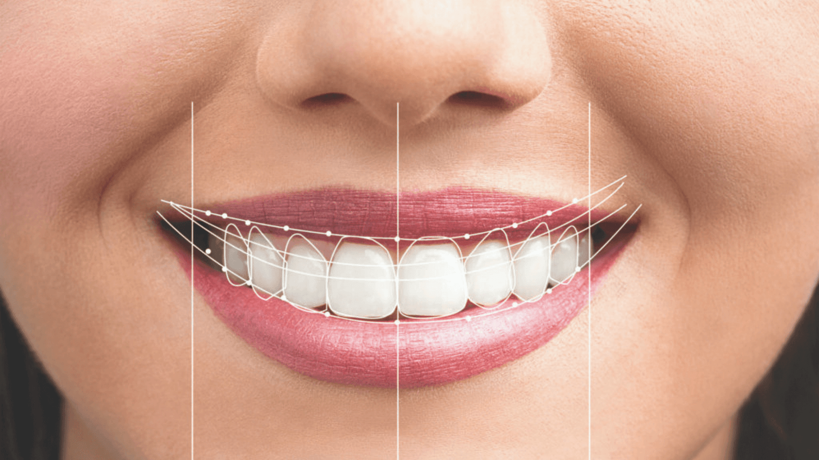 Deja de ocultar tu boca: cómo tener una sonrisa bonita sin importar tu edad
